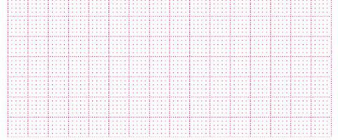 Registrierpapier für Carefusion (GE Hellige) - 10 Stück x 360 Blatt