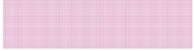 EKG-Thermopapier für SCHILLER EKG MS-2015, 210 x 140 mm, 10 Stück á 180 Blatt