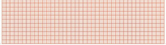 EKG-Thermopapier für SCHILLER EKG CS-6/12, 210 x 150 mm, 10 Stück á 298 Blatt