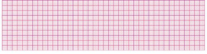 EKG-Thermopapier für SCHILLER EKG AT-10/SP-10, 210 x 140 mm, 10 Stück á 158 Blatt