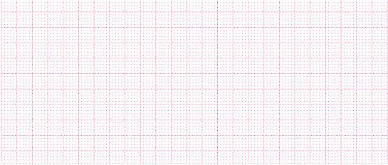 Registrierpapier für Carefusion (GE Hellige) EK53/56 - 10 Stück x 370 Blatt