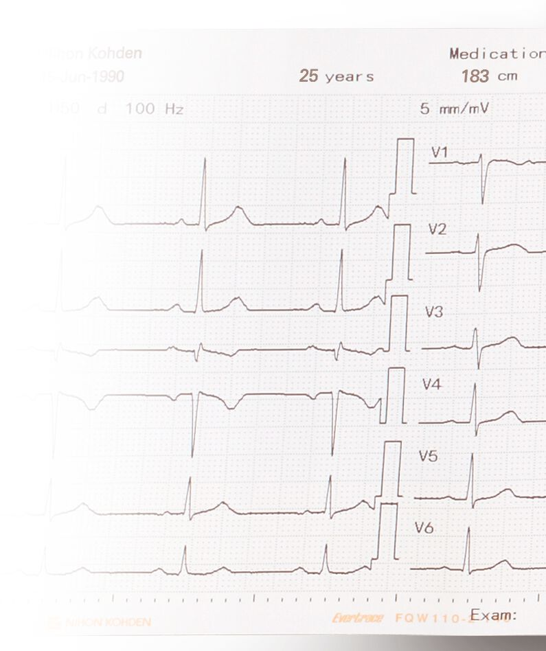 Nihon Kohden Registrierpapier für ECG 2150, 2250 und 2350 - 1 Stück