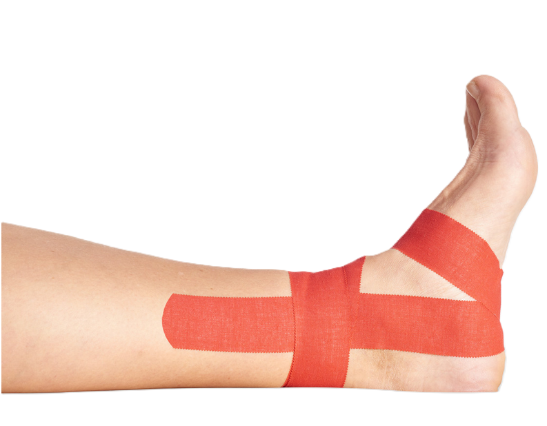 miro-tape Pflasterbinde - 3,75 cm x 10 m - rot - 12 Stück