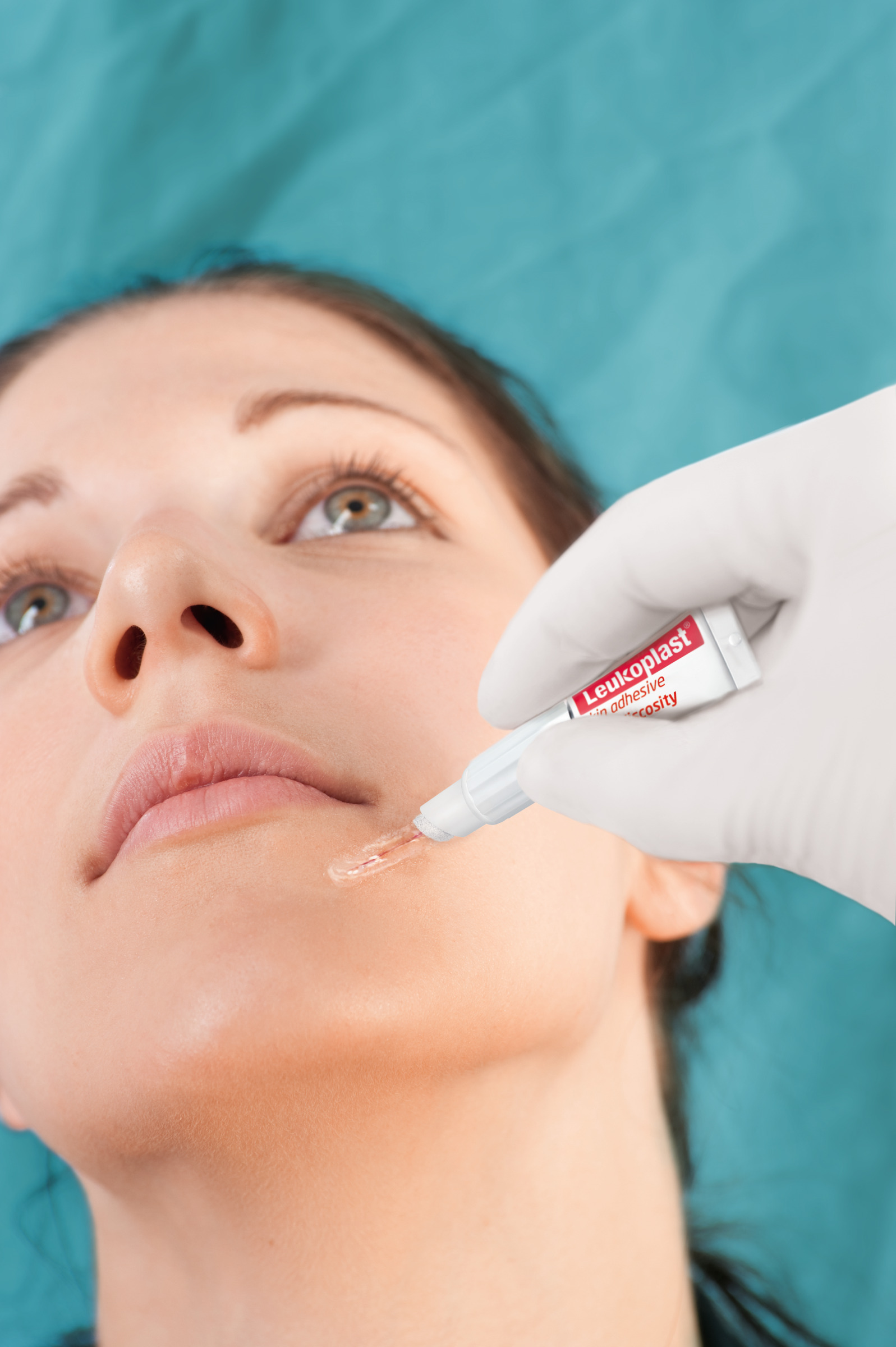 essity Leukoplast® skin adhesive Hautkleber - 0.7 ml - 10 Stück