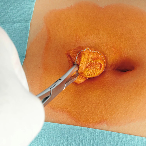 Hartmann Hautdesinfektion Cutasept® G - gefärbt - 1 Liter Flasche