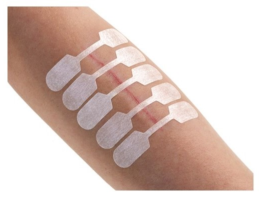 STERIGRAP® Wundnahtstreifen 32 x 8 mm, Knochenform - 10 Stück